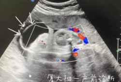 孕妇发脾气对胎儿有什么影响（怀孕四个月经常生气哭对胎儿有什么影响）