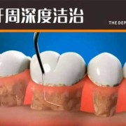 孕妇牙齿松动怎么办？孕妇牙齿松是怎么回事,孕期牙齿松动怎么办可以拔掉吗
