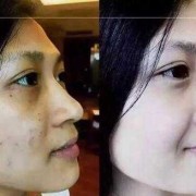 孕期祛斑小妙招（孕期祛斑小妙招有哪些）