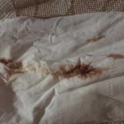 怀孕初期老流褐色血怎么办,孕期流血褐色怎么回事