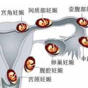 胎儿是生活在（  ） ，A．输卵管，B．子宫，C．卵巢，D．阴,胎儿卵巢囊肿是什么原因引起的