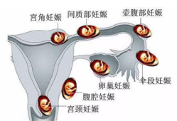 胎儿是生活在（  ） ，A．输卵管，B．子宫，C．卵巢，D．阴,胎儿卵巢囊肿是什么原因引起的
