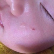 三个多月宝宝脸蛋经常红红的，脸蛋肉硬，怎么回事,三个多月胎儿图片有多大