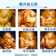 四维彩超是检查什么的,四维彩超看胎儿性别图解