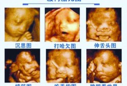 四维彩超是检查什么的,四维彩超看胎儿性别图解