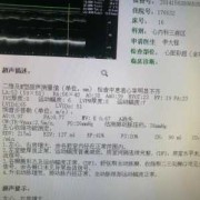请问心脏彩超能查出心衰吗？心衰会有什么样的症状啊？谁知道吗,胎儿心脏增大有危险吗