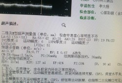 请问心脏彩超能查出心衰吗？心衰会有什么样的症状啊？谁知道吗,胎儿心脏增大有危险吗