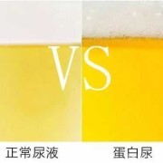 宝宝尿有异味,胎儿尿液排到哪里