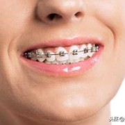 孕期矫正牙齿（孕期矫正牙齿有影响吗）
