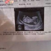 孕12周胎儿图（孕12周，孕吐越来越严重，怎么办）