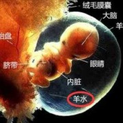 羊水偏多对胎儿有影响吗,羊水多对胎儿有什么影响吗