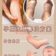 缓解孕期水肿（孕妇脚浮肿怎么缓解?怀孕九个多月，水肿很厉害有什么办法能改善）