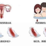 孕期阴道出血（孕期下面出血但不疼什么情况）