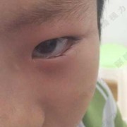 婴儿睫毛多长算是长,胎儿长短腿产检可以检查出吗
