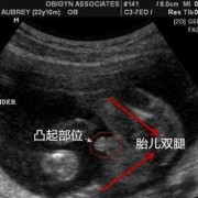 如何鉴定胎儿是谁的（如何鉴定胎儿是谁的孩子）