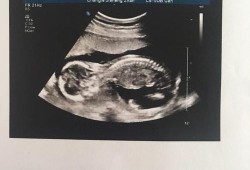 18周胎儿多大（怀孕18周胎动的感觉是怎样的）