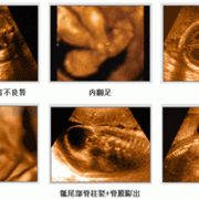 11周胎儿四维彩超图（11d在地理学中代表什么）