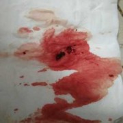 孕期见红怎么回事（梦见孕期见红怎么回事）