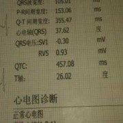 怀孕有9周了，产检结果见微弱原始心管搏动，这是什么意思,怀孕第九周胎儿发育图