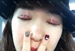越南人都是双眼皮吗,孕期变双眼皮怎么办