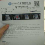 胎儿胆囊偏小怎么办（提示胎儿胆囊显示不清,这说明什么情况）