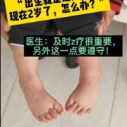 胎儿右脚内翻（新生儿轻微脚内翻是怎么回事呢）