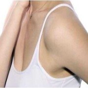 腋下长了副乳怎么办,孕期副乳图片大全