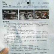 胎儿后脑窝（胎儿后脑窝池增宽13mm会脑瘫吗）