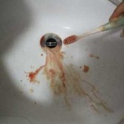 孕妇能刷牙洗脸吗,孕期刷牙总是出血是什么原因