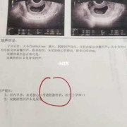胎心正常胎儿就正常吗（胎心正常胎儿就正常吗会胎停吗）