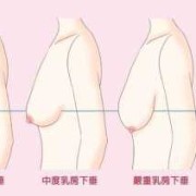 孕期乳头变大（孕期乳头变大了是什么情况）