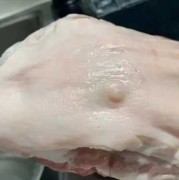 买了块猪肉，上面有个乳头能吃吗,孕期吃乳头疼怎么办