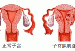 孕期子宫前壁（孕期子宫前壁是什么意思）