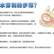 孕期穿刺（羊膜穿刺是检查什么）