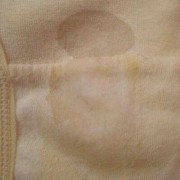 孕期白带有异味（怀孕内裤总是湿还腥臭）