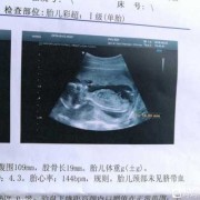 孕17周胎儿图片欣赏（孕17周胎儿图片真实图片）