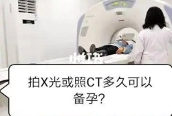 怀孕能拍X光片和CT吗,备孕期间可以做ct检查吗