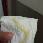 怀孕后的白带是什么样子的,