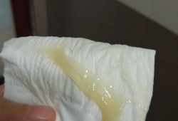 怀孕后的白带是什么样子的,