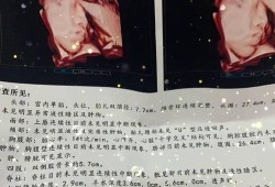 孕29周胎儿腿短怎么办？我怀孕29周，b超显示胎儿股骨长5.4,胎儿腿短5周怎么办