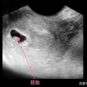 孕期第6周（孕期第6周的模样）