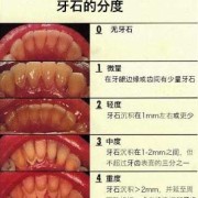 孕期牙酸（孕9周2天。每天都吐酸水，吐到牙酸倒。怎么回事）