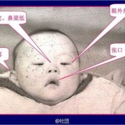 胎儿能查出弱智吗（怎么才能知道宝宝的智力是否正常）