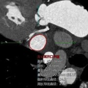 请问胎儿B超中HC,AC,HL是什么意思,胎儿超声hc是什么意思啊