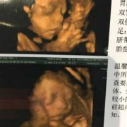 四维胎儿图片（孩子四维报喜朋友圈）