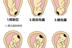 胎儿位置不好（胎儿位置不好怎么调整）