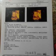 孕妇做彩超对胎儿有影响吗（怀孕彩超能检查出什么？一般怀孕多长时间可以做呢）