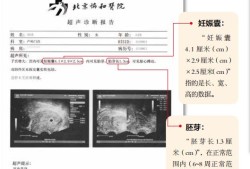 孕期hcg高（孕七周做B超检查胎心胎芽正常，但HCG值翻倍不好有问题吗）