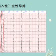 胎儿房性早搏（胎儿房性早搏）