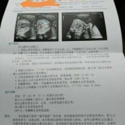 胎儿心脏彩超内有强回声点严重吗,胎儿心脏不好早期10个征兆
